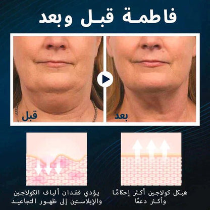 جهاز التجميل ومنع الشخير المعجزة اثناء النوم - Makfool